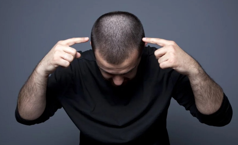 Is hair loss a side effect of Modafinil